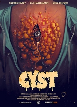 Cyst-hd